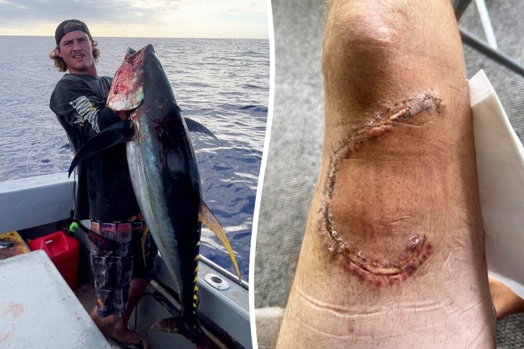 Spearfisherman survived shark attack by making tourniquet from