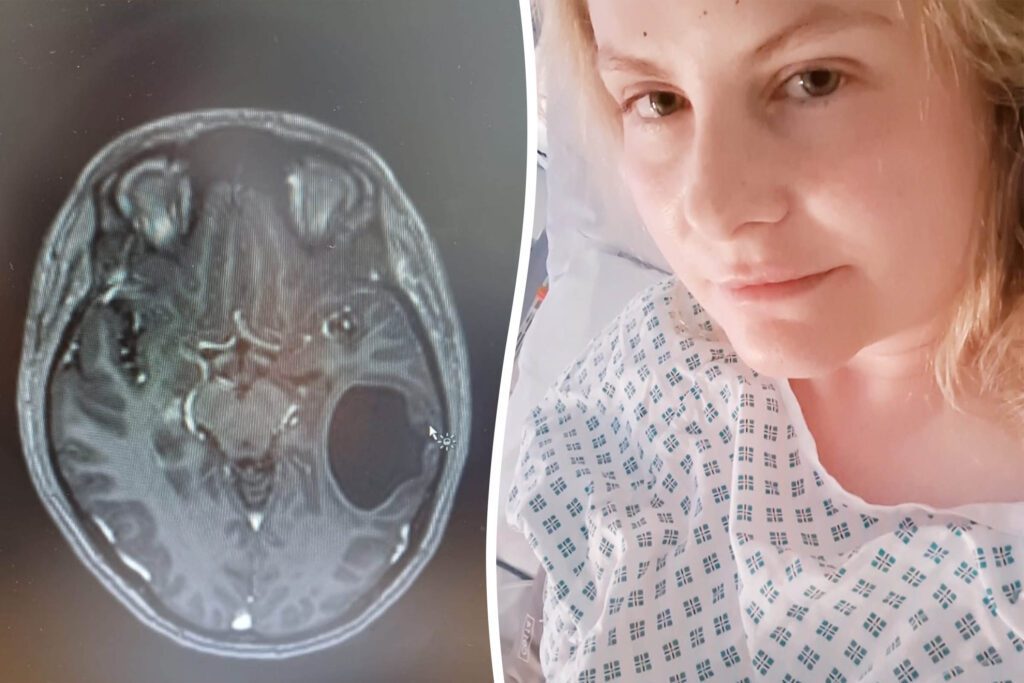 Woman remortgages home to fund treatment for terminal brain cancer - Discover SWNS